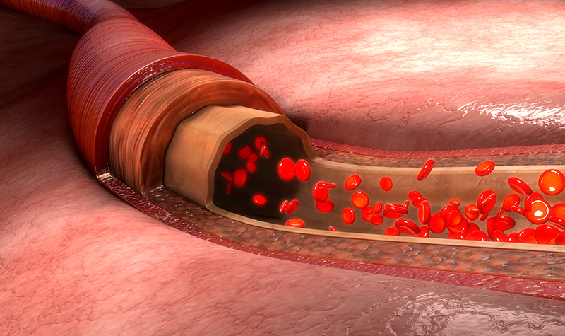 亚健康怎么调理恢复快？水蛭素来改善